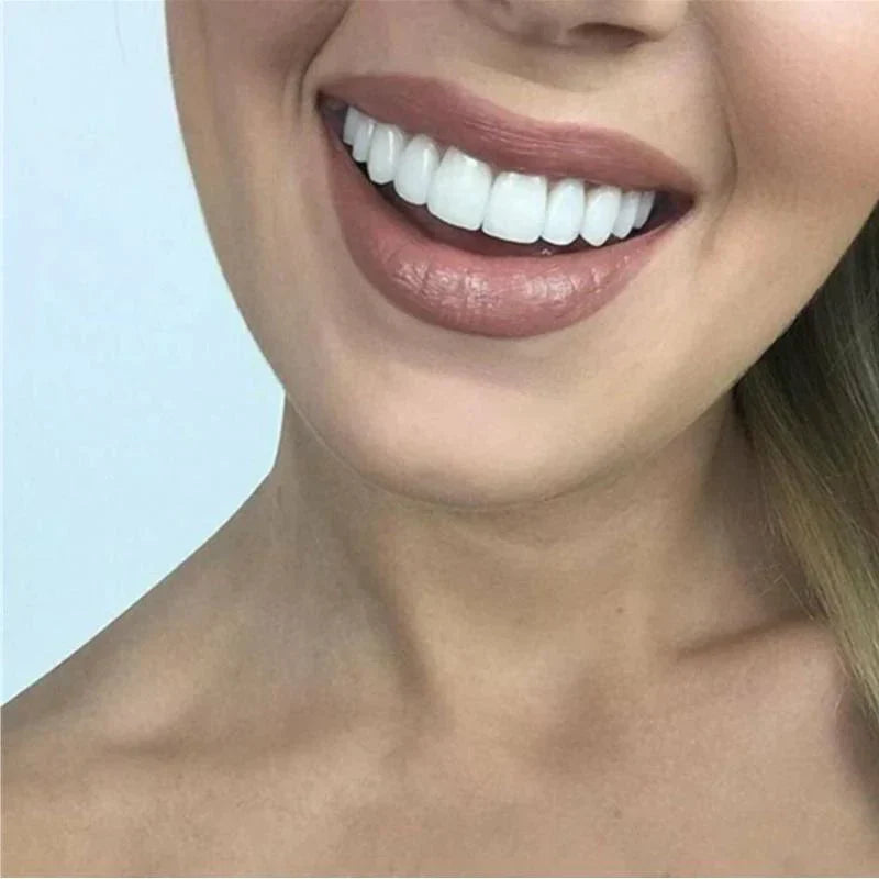 Lune London | SnapFit Dental Restoration | Always a Perfect Smile