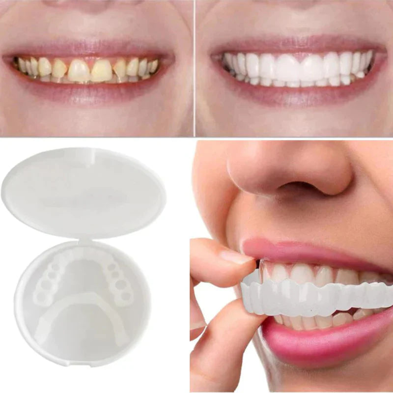 Lune London | SnapFit Dental Restoration | Always a Perfect Smile
